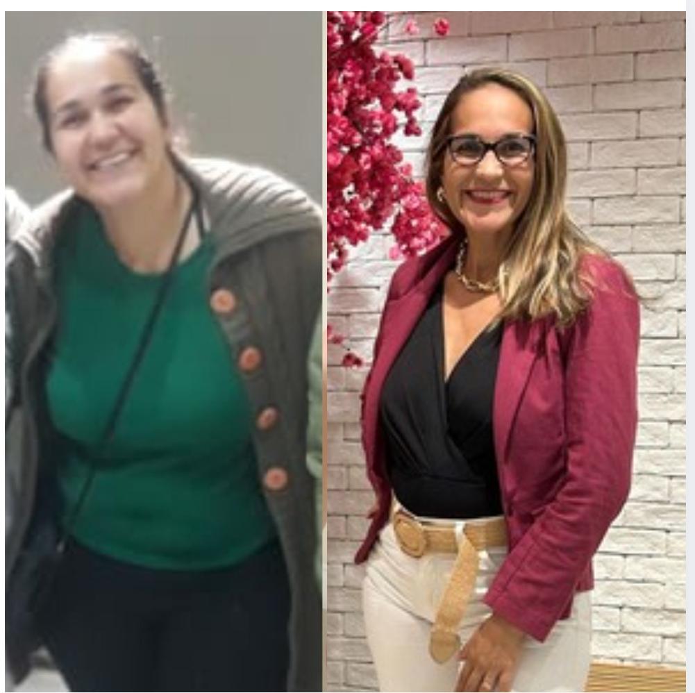 Transformação de Giselle no método EIXA